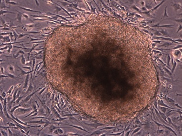 induced pluripotent stem cell colony made with phic31 integrase