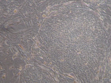 induced pluripotent stem cell
              colony made with phic31 integrase