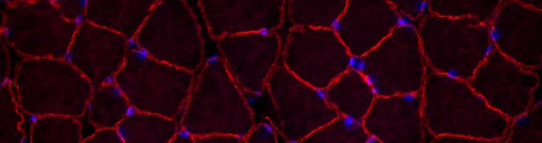 dystrophin in dysferlin-deficient
              A/J skeletal muscle